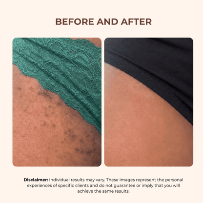 BBL Serum - FlexoFit